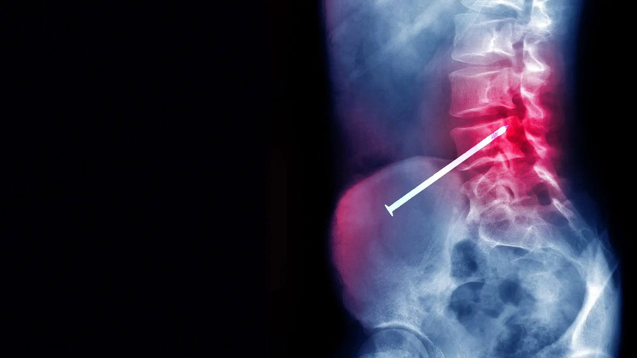 Body Invaders backdrop