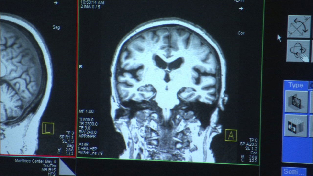 The Alzheimer's Project backdrop