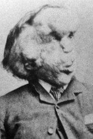 Photo of Joseph Merrick