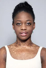 Photo of Michaela DePrince as Self