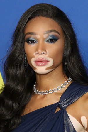 Winnie Harlow photo