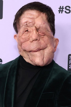 Adam Pearson photo