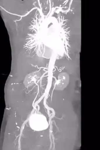 Movie poster for X-Ray Eros (2025)