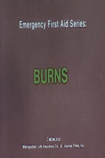 Movie poster for Emergency First Aid Series: Burns (1980)