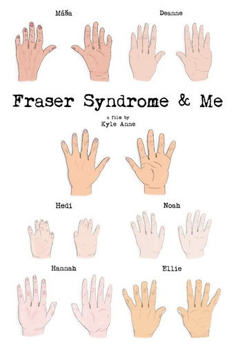 Movie poster for Fraser Syndrome & Me (2018)