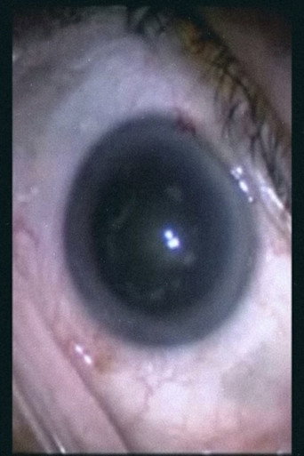 Movie poster for Botched Eyeball Operation (2007)
