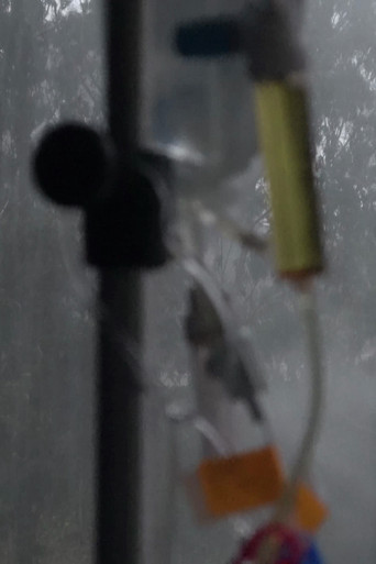 Movie poster for Knot (Fog, Eucalyptus, Methotrexate) (2024)