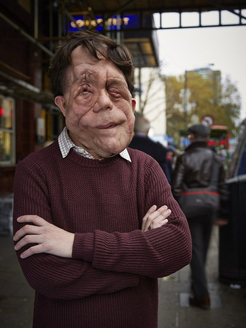 Movie poster for The Ugly Face of Disability Hate Crime (2015)