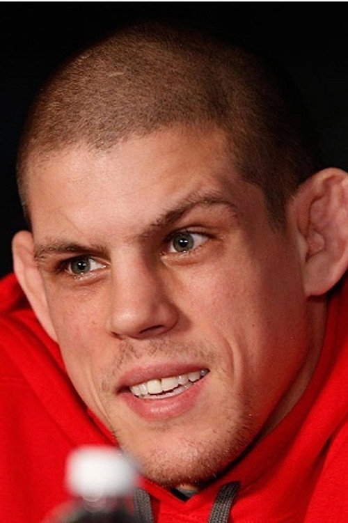 Photo of Joe Lauzon, Acting