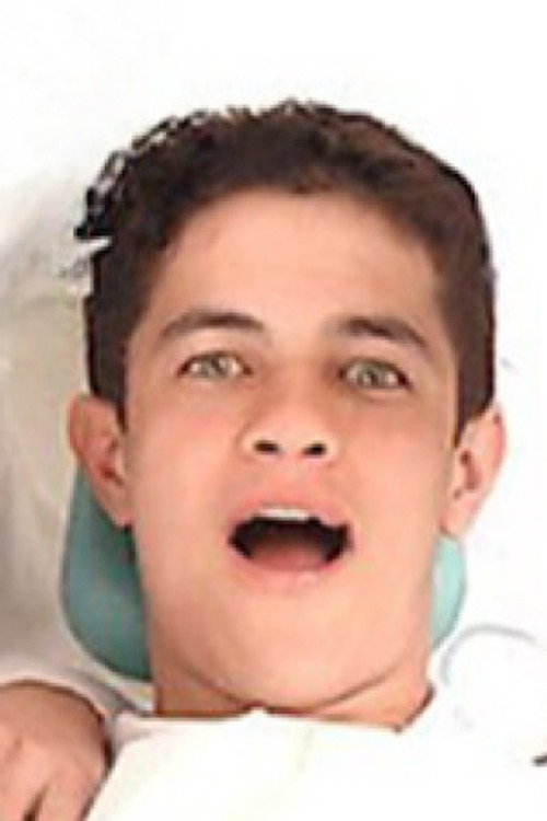 Photo of Carlos, Acting