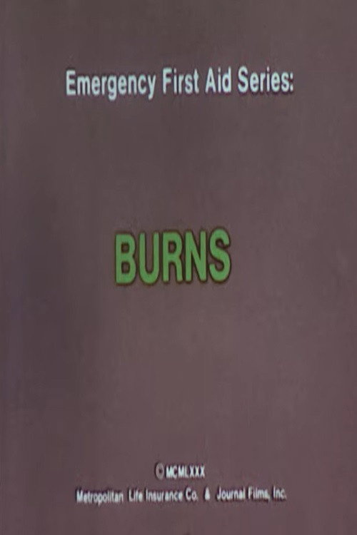 Movie poster for Emergency First Aid Series: Burns (1980)