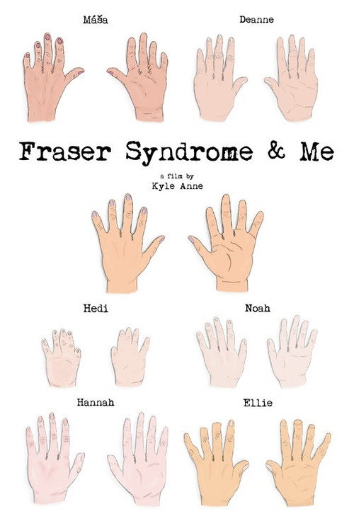 Movie poster for Fraser Syndrome & Me (2018)
