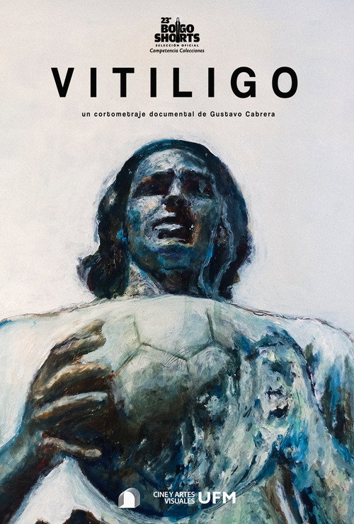 Movie poster for Vitiligo (2025)