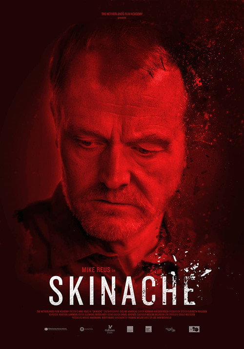 Movie poster for Skinache (2017)