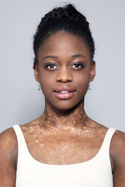 Photo of Michaela DePrince, Acting