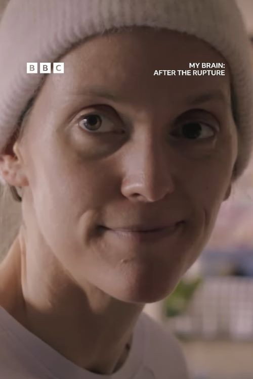 Movie poster for My Brain: After the Rupture (2025)