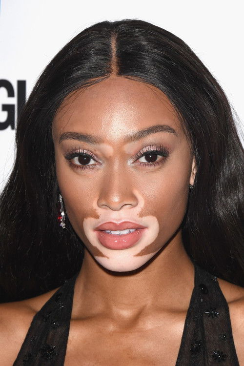 Winnie Harlow profile