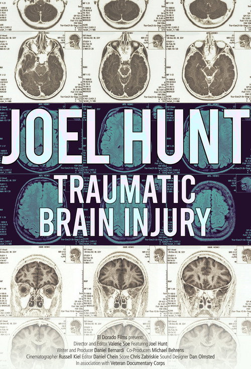Movie poster for Joel Hunt: Traumatic Brain Injury (TBI) (2015)