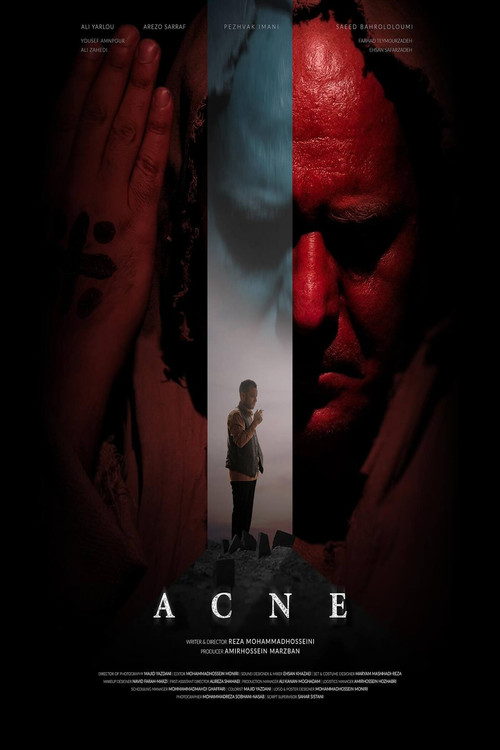 Movie poster for Acne (2025)