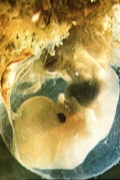 Movie poster for Schwangerschaft und Geburt (1982)