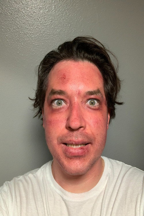 Photo of Alex Dickey, Acting