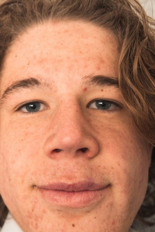 Photo of Sam Dreise, Acting