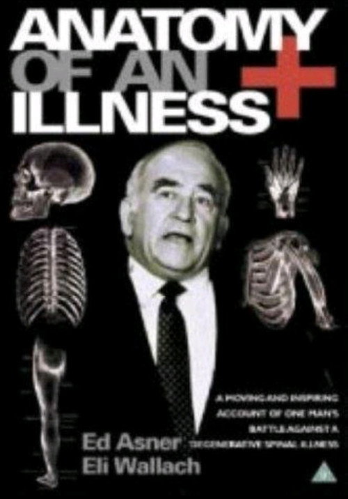 Movie poster for Anatomy of an Illness (1984)