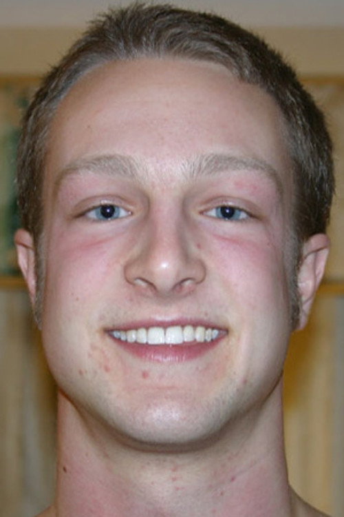 Photo of Brock, Acting