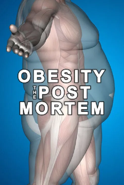 Movie poster for Obesity: The Post Mortem (2016)