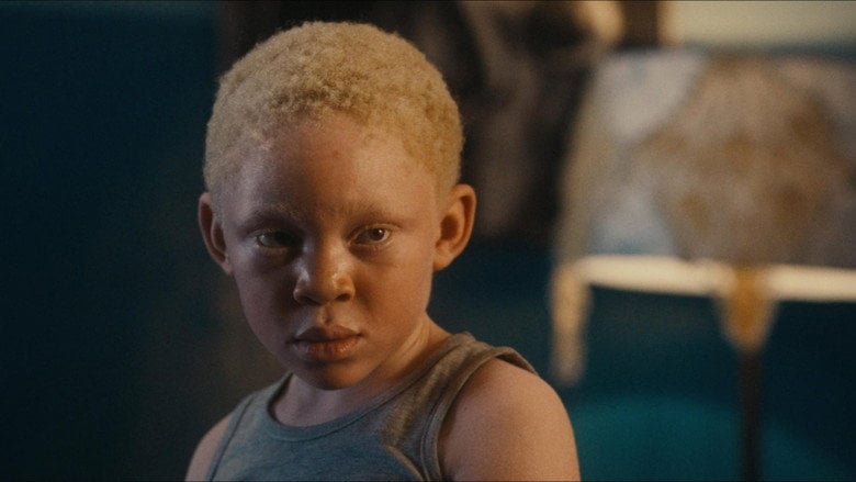 A young boy with albinism sits alone on a dusty road, his shadow stretching long behind him